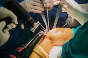 Robotic knee replacement in Chandigarh