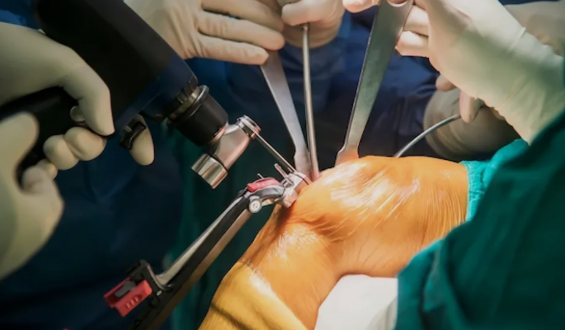 Robotic knee replacement in Chandigarh