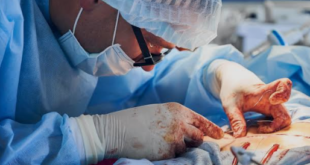 hip replacement surgery in Mohali