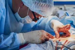 hip replacement surgery in Mohali