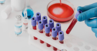 CBC test price in Chandigarh