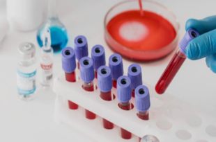 CBC test price in Chandigarh