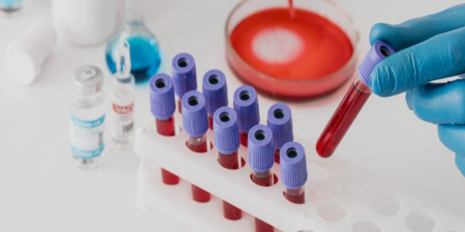 CBC test price in Chandigarh
