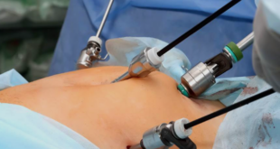 Laparoscopic surgery in Mumbai