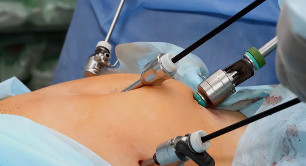 Laparoscopic surgery in Mumbai