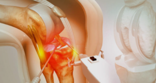 knee replacement surgery in Jaipur