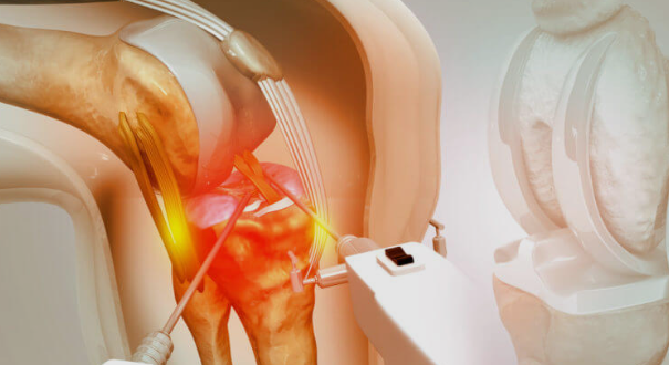 knee replacement surgery in Jaipur