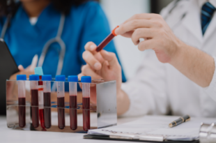 Book blood tests online Chandigarh