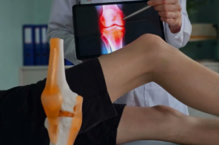 joint replacement surgery in Goa