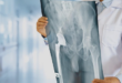 Hip replacement loosening treatment Chandigarh