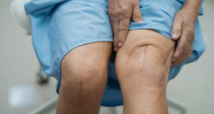 Knee Replacement Surgery Goa