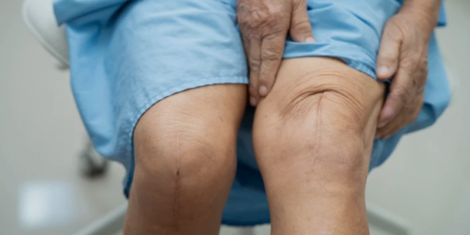 Knee Replacement Surgery Goa
