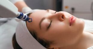 acne scar treatment in Chandigarh
