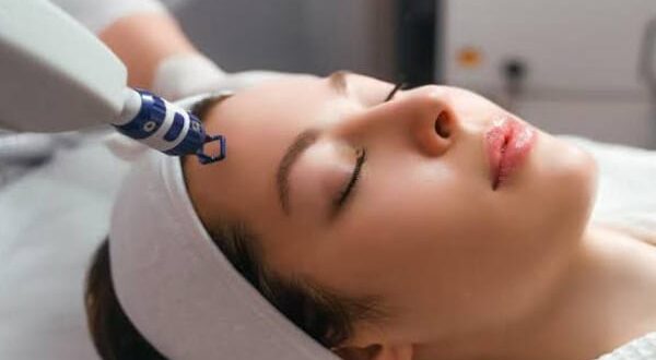 acne scar treatment in Chandigarh