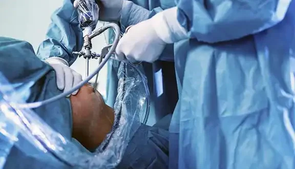Arthroscopy Surgeon Goa