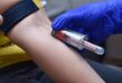 Book blood test online Chandigarh