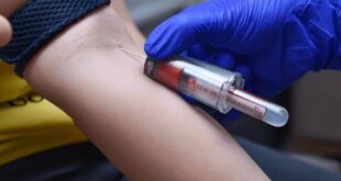 Book blood test online Chandigarh