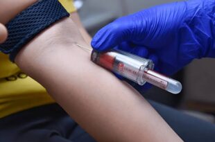 Book blood test online Chandigarh