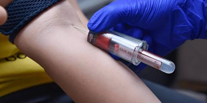 Book blood test online Chandigarh