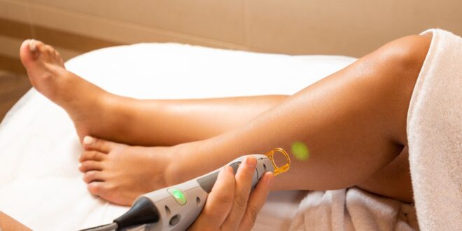best laser hair removal clinic in Mohali