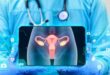 Best Gynaecologist in Chandigarh