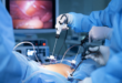 Laparoscopic Surgery in Kandivali