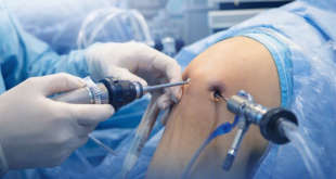 arthroscopy surgery in Goa