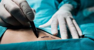 Laparoscopic Ovarian Surgeon in Panchkula