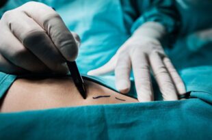 Laparoscopic Ovarian Surgeon in Panchkula