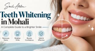 teeth whitening in Mohali.