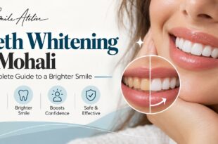 teeth whitening in Mohali.